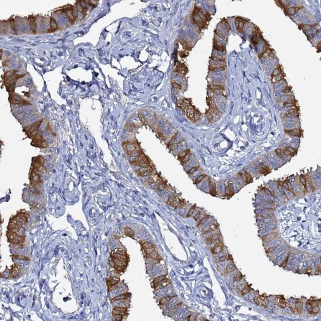 RABL2A Antibody in Immunohistochemistry (IHC)