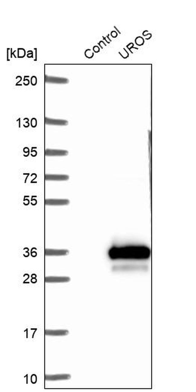 UROS Antibody in Western Blot (WB)