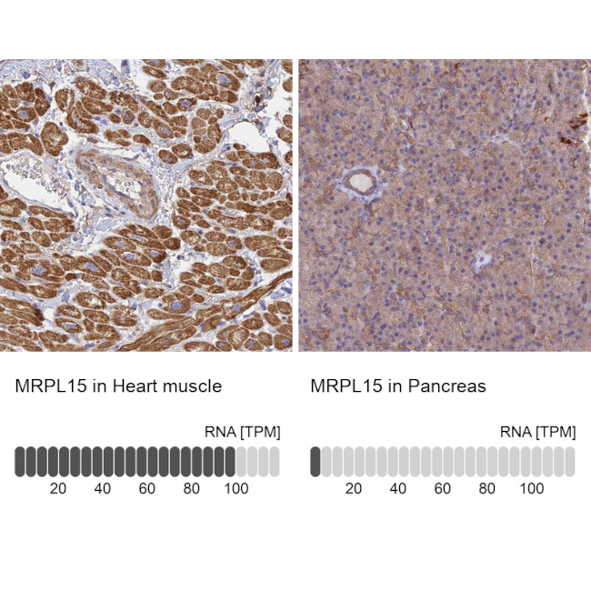 MRPL15 Antibody in Immunohistochemistry (IHC)