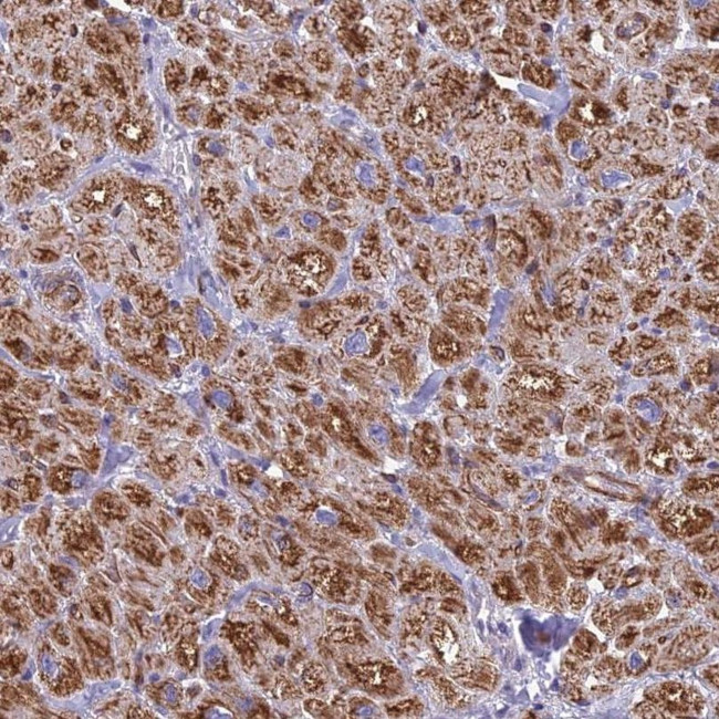 POMGNT1 Antibody in Immunohistochemistry (IHC)