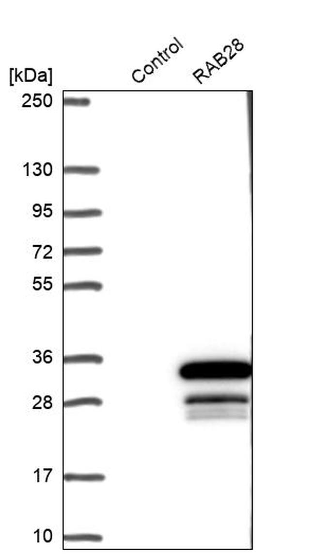 RAB28 Antibody in Western Blot (WB)