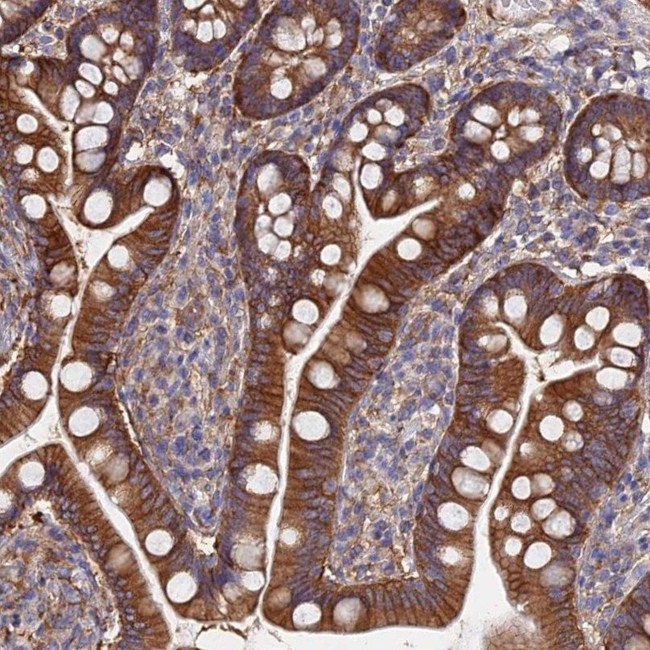 GPR41 Antibody in Immunohistochemistry (IHC)