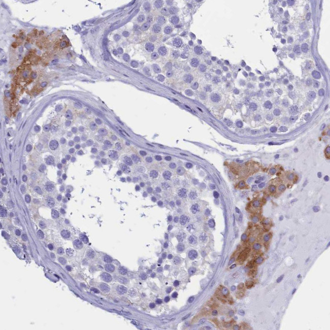 TMEM97 Antibody in Immunohistochemistry (IHC)