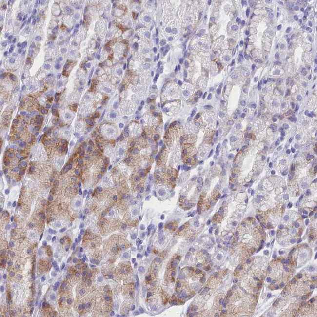 TMEM97 Antibody in Immunohistochemistry (IHC)