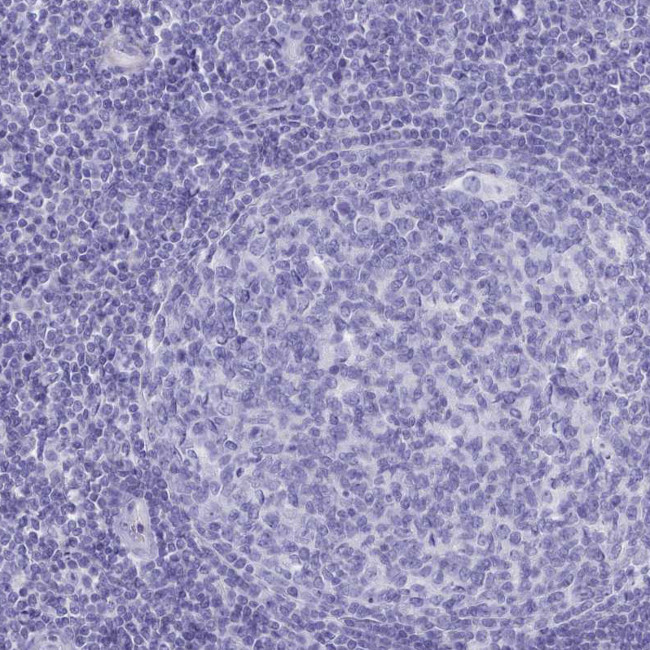 TMEM97 Antibody in Immunohistochemistry (IHC)