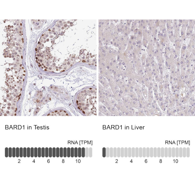 BARD1 Antibody in Immunohistochemistry (IHC)