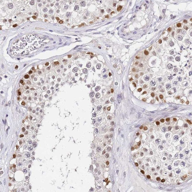 LSM3 Antibody in Immunohistochemistry (IHC)