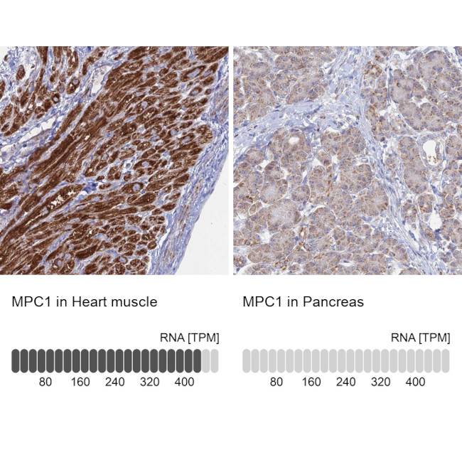 BRP44L Antibody in Immunohistochemistry (IHC)