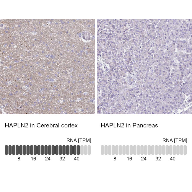 HAPLN2 Antibody in Immunohistochemistry (IHC)