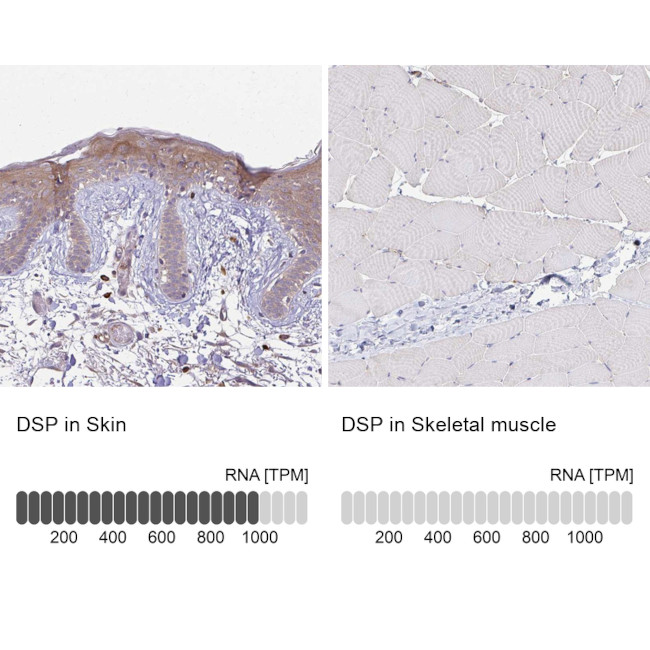 Desmoplakin Antibody