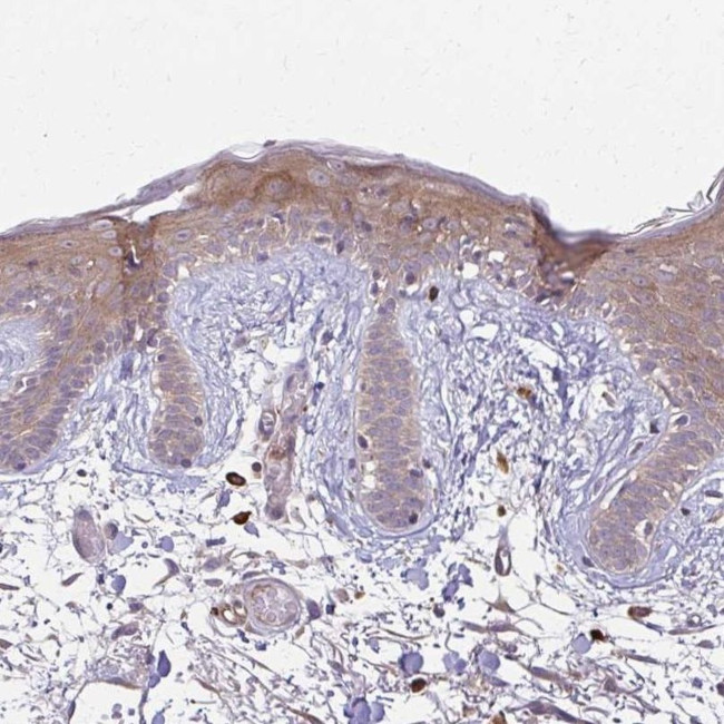 Desmoplakin Antibody in Immunohistochemistry (IHC)