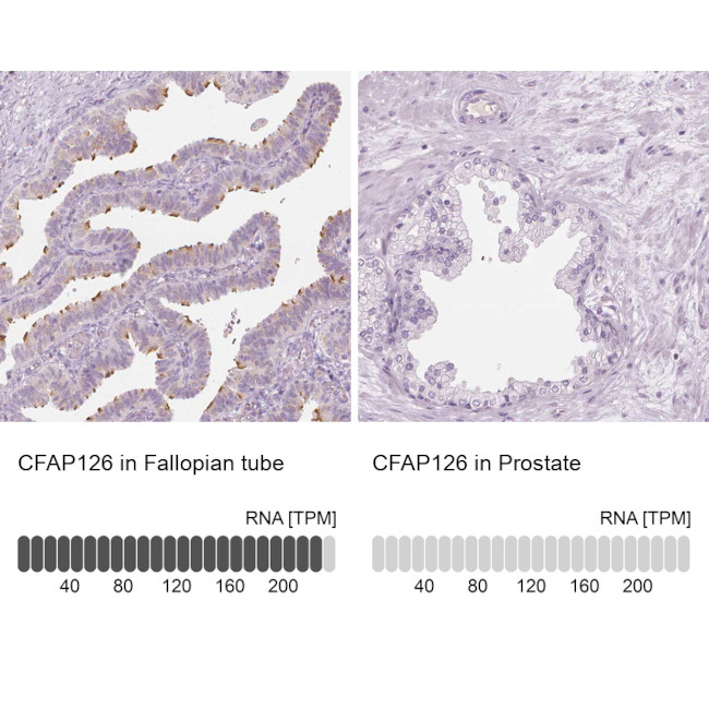 CFAP126 Antibody in Immunohistochemistry (IHC)