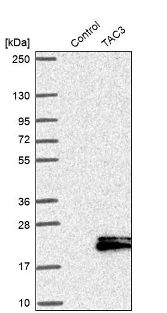 NKB Antibody in Western Blot (WB)