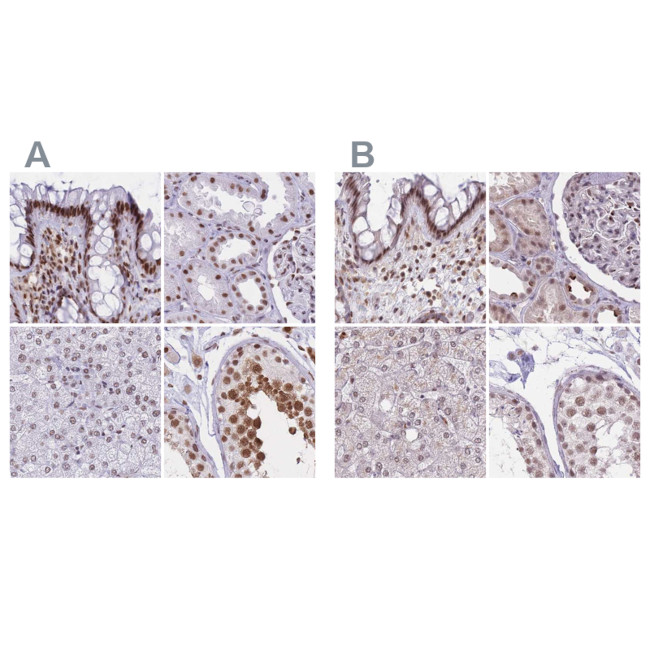 hnRNP UL1 Antibody in Immunohistochemistry (IHC)