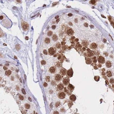 hnRNP UL1 Antibody in Immunohistochemistry (IHC)