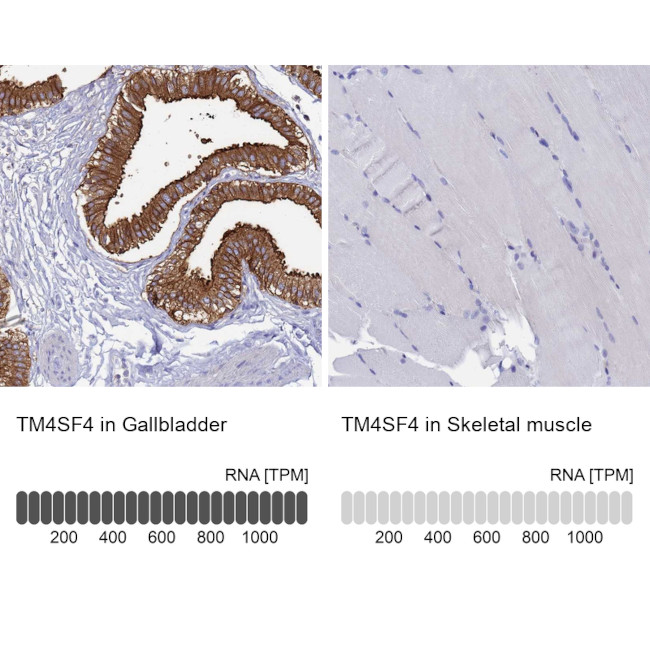 TM4SF4 Antibody