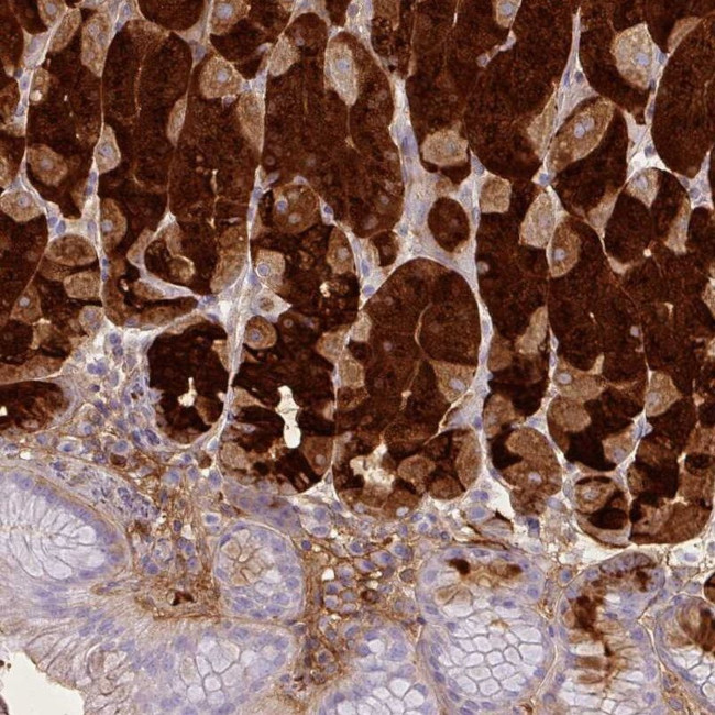 PGA3 Antibody in Immunohistochemistry (IHC)