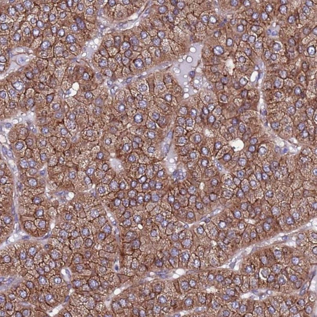 EI24 Antibody in Immunohistochemistry (IHC)