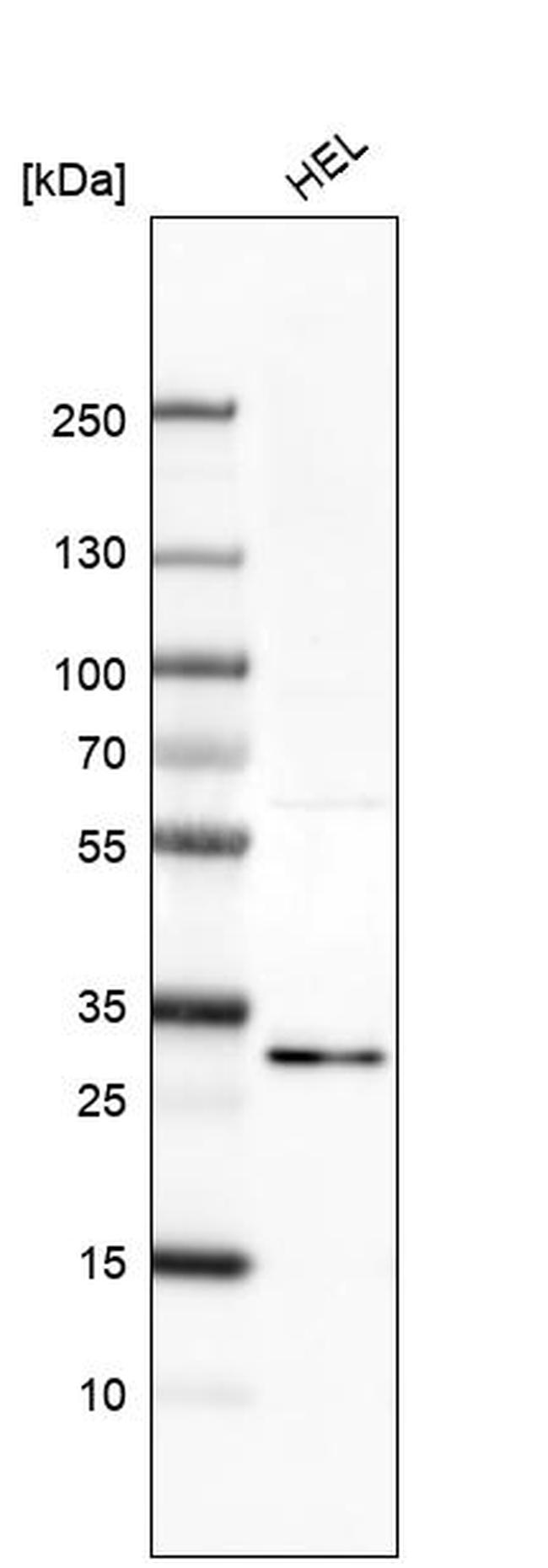 EI24 Antibody in Western Blot (WB)