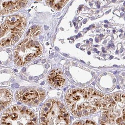 NAPSA Antibody in Immunohistochemistry (IHC)