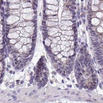 NAPSA Antibody in Immunohistochemistry (IHC)