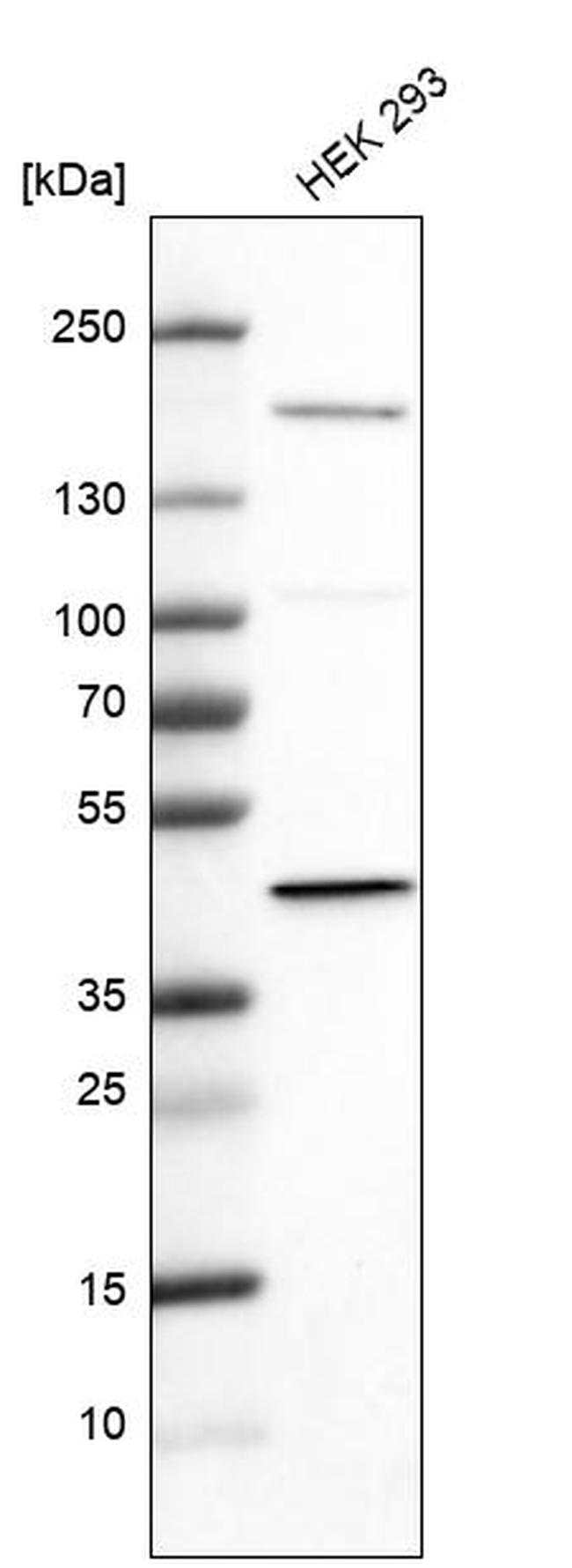 PDHA2 Antibody in Western Blot (WB)