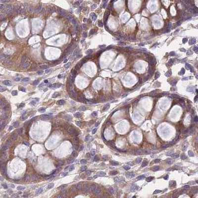 PFDN6 Antibody in Immunohistochemistry (IHC)