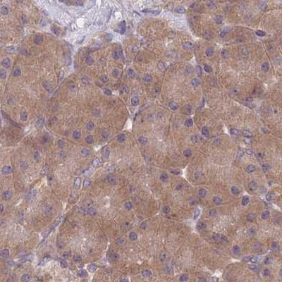 PFDN6 Antibody in Immunohistochemistry (IHC)