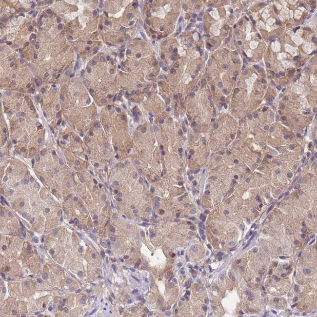 PFDN6 Antibody in Immunohistochemistry (IHC)