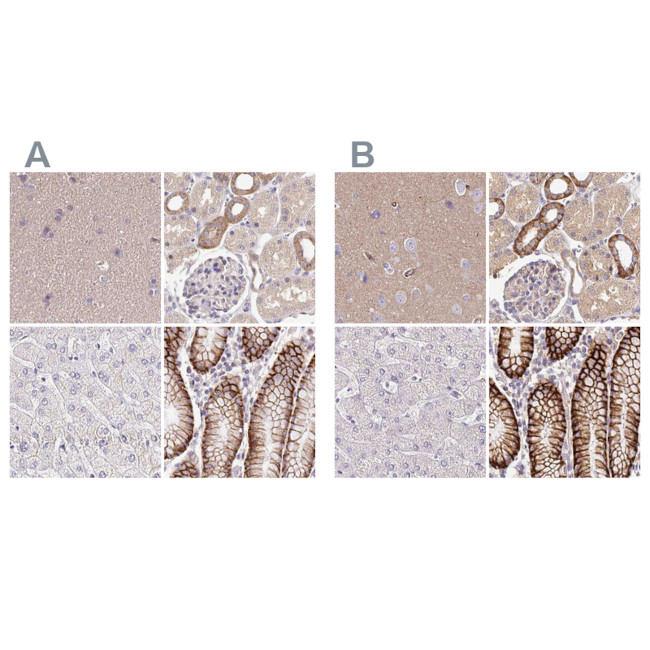 Nhe-1 Antibody in Immunohistochemistry (IHC)