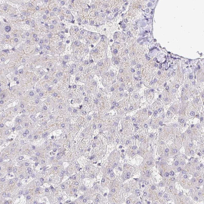 Nhe-1 Antibody in Immunohistochemistry (IHC)