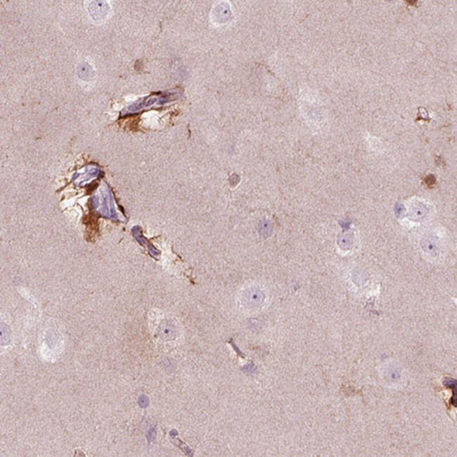 KCNG2 Antibody in Immunohistochemistry (IHC)