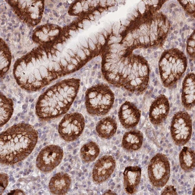 LDHD Antibody in Immunohistochemistry (IHC)