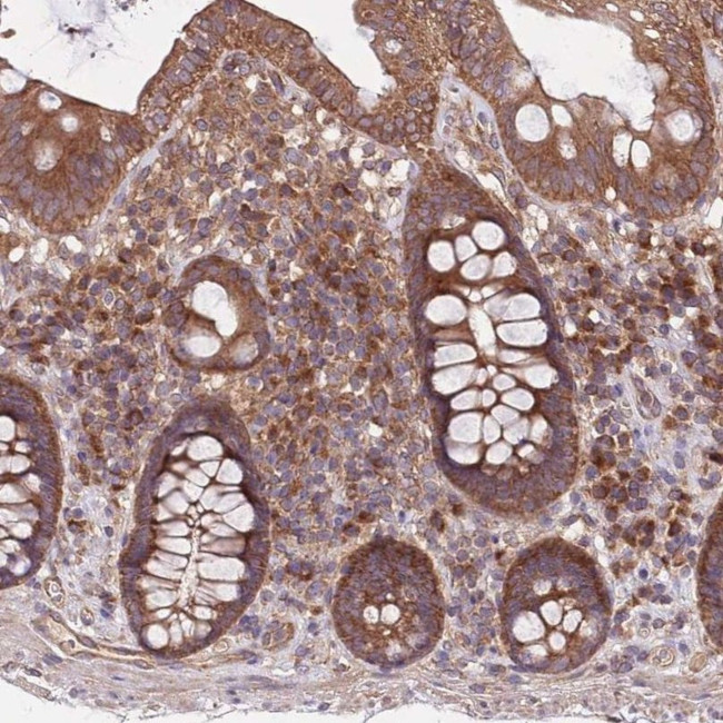 MFNG Antibody in Immunohistochemistry (IHC)