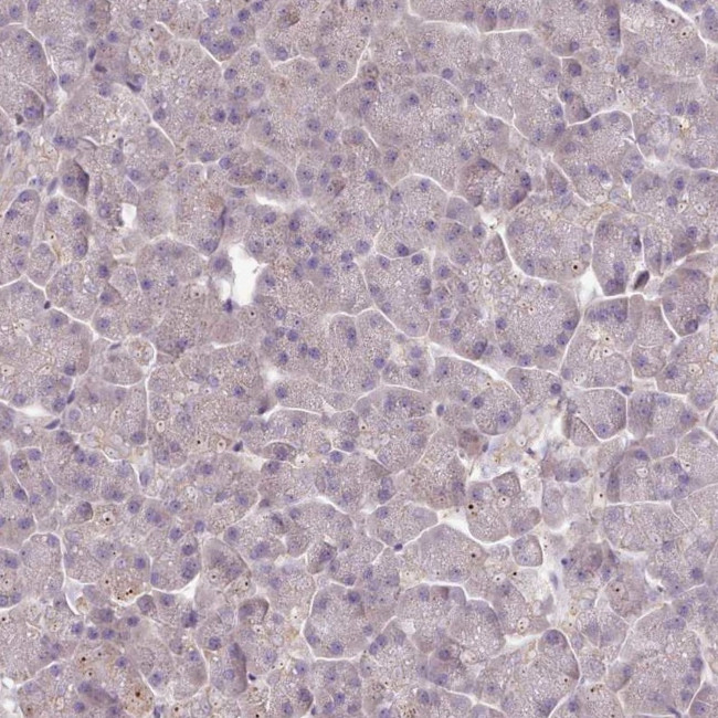 DPF1 Antibody in Immunohistochemistry (IHC)