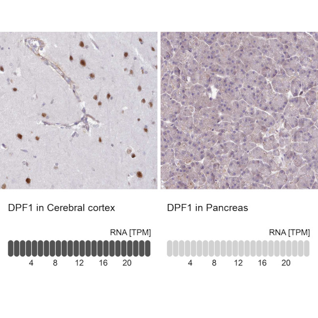 DPF1 Antibody