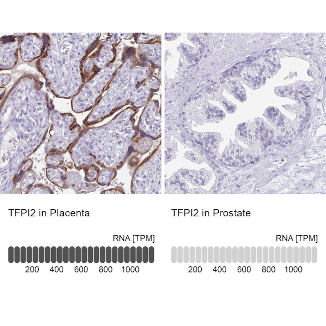 TFPI2 Antibody in Immunohistochemistry (IHC)