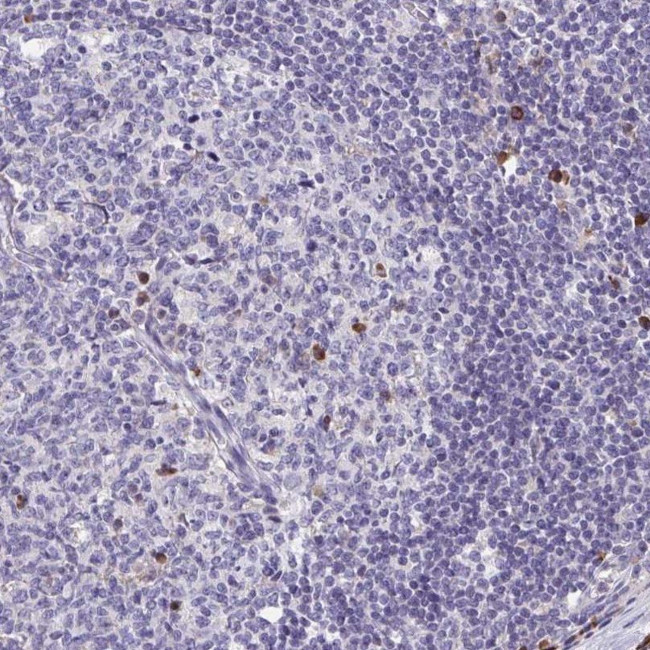 FKBP2 Antibody in Immunohistochemistry (IHC)