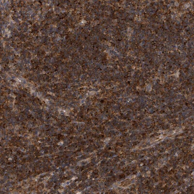 LILRA4 Antibody in Immunohistochemistry (IHC)