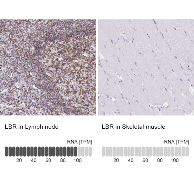 Lamin B Receptor Antibody in Immunohistochemistry (IHC)