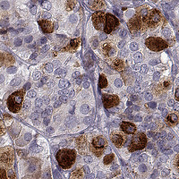 GAL Antibody in Immunohistochemistry (IHC)