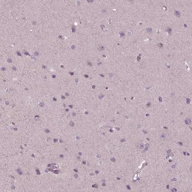 GAL Antibody in Immunohistochemistry (IHC)