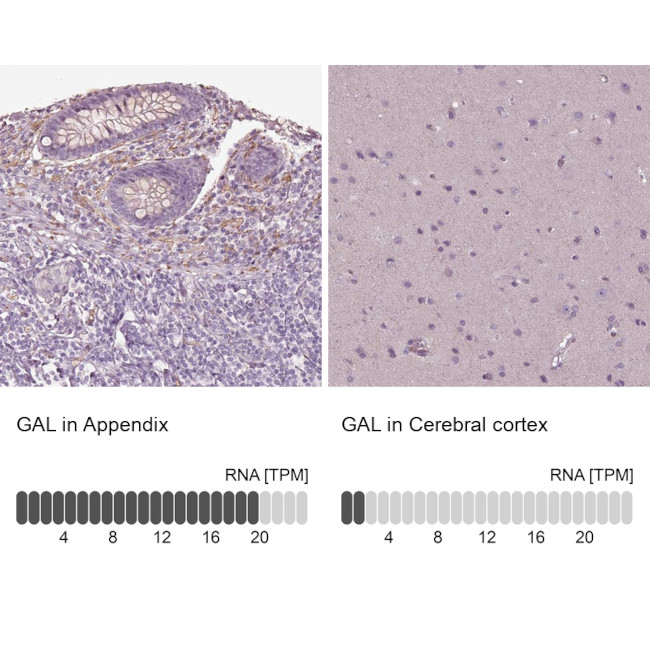 GAL Antibody