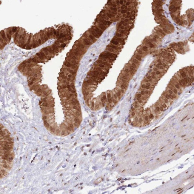 TRIM32 Antibody in Immunohistochemistry (IHC)