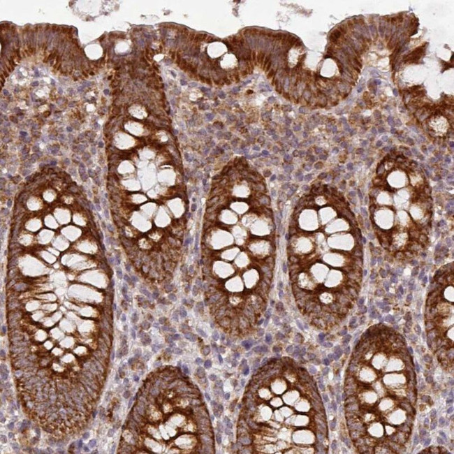 MRPS16 Antibody in Immunohistochemistry (IHC)