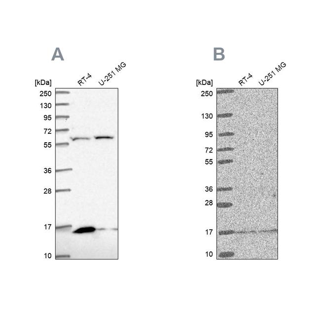 MRPS16 Antibody in Western Blot (WB)