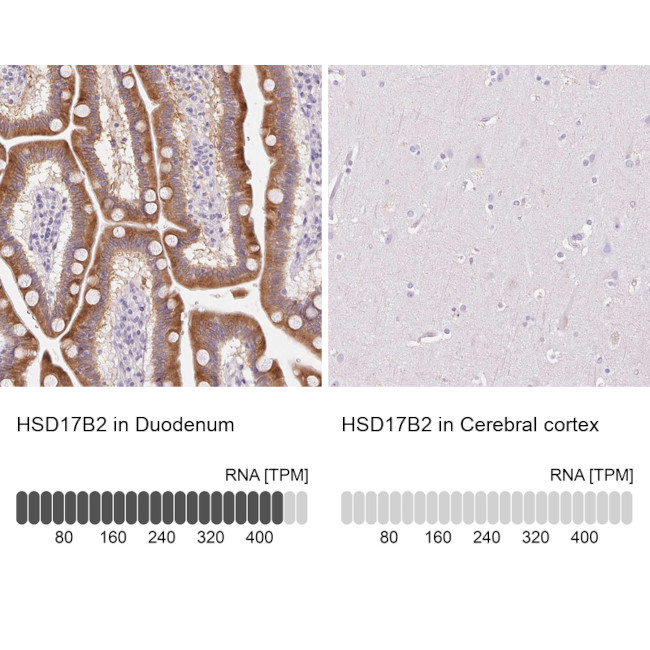 HSD17B2 Antibody