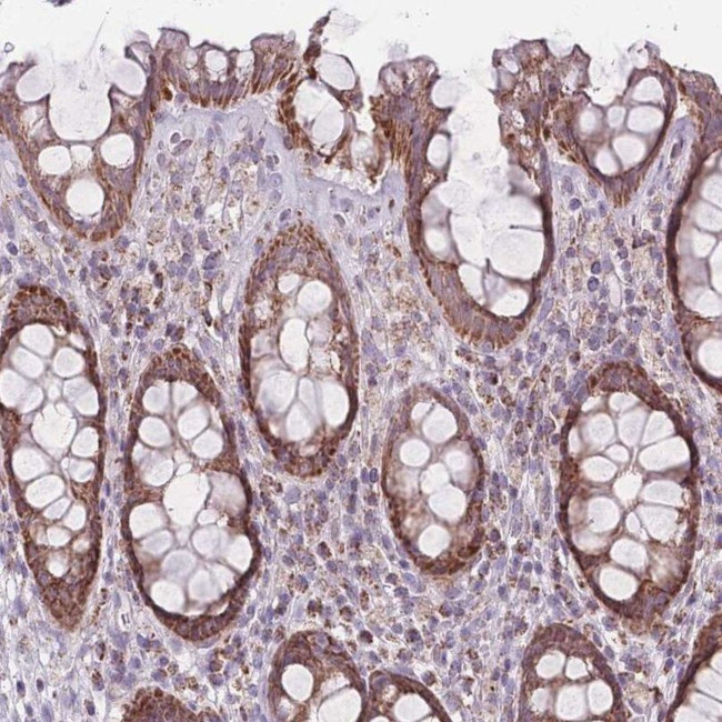 DCHS1 Antibody in Immunohistochemistry (IHC)