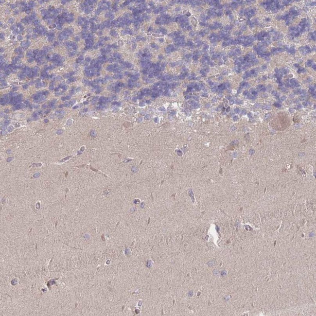 MRPS18B Antibody in Immunohistochemistry (IHC)