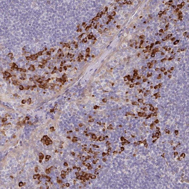 TRAPPC10 Antibody in Immunohistochemistry (IHC)